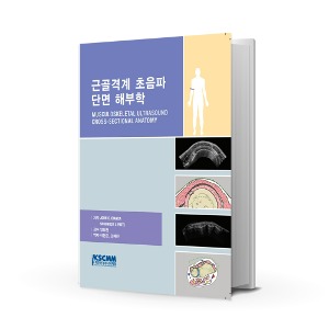 [도서] 근골격계 초음파 단면 해부학 (A04802)